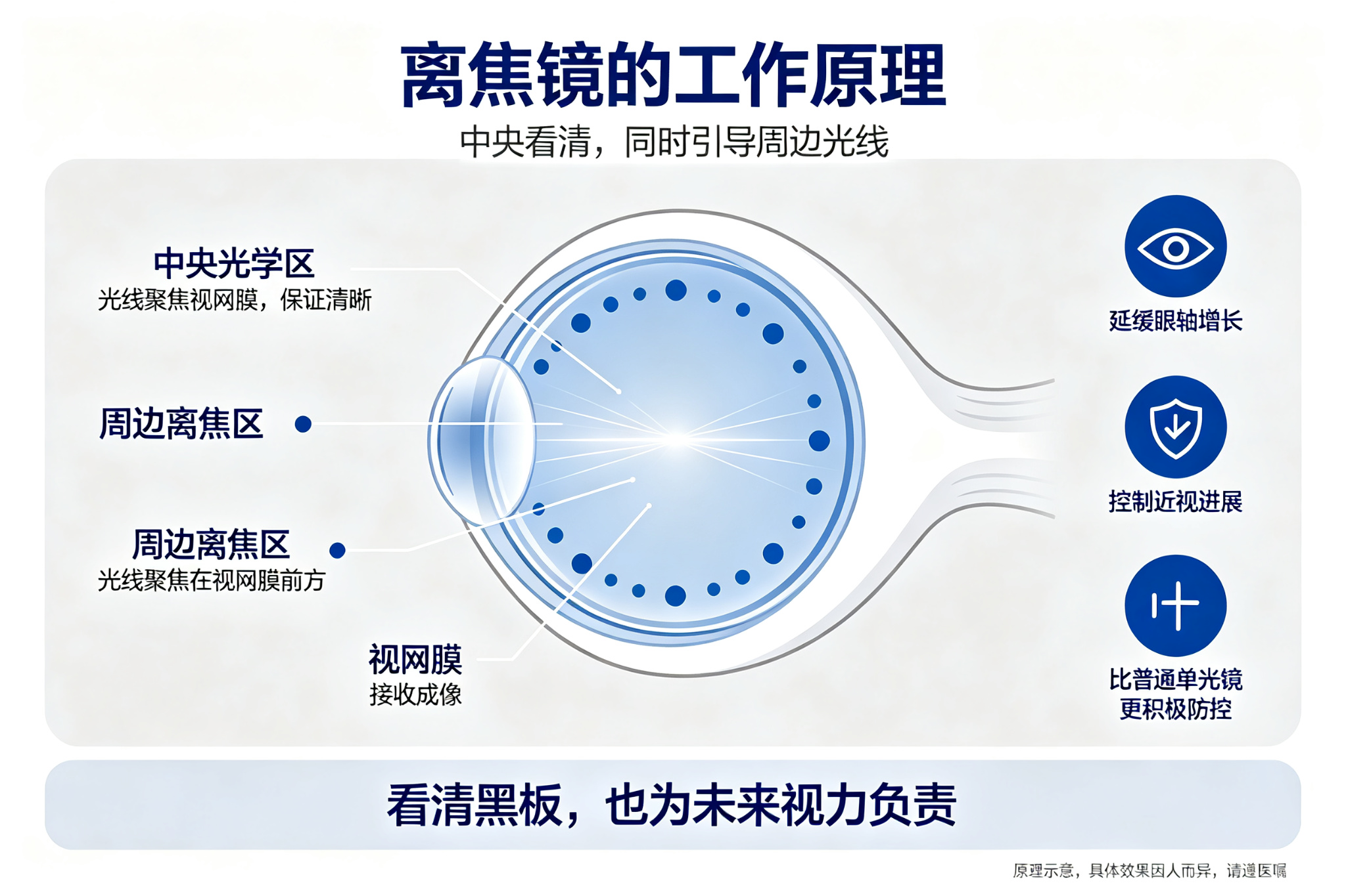 昆明儿童离焦镜验配——离焦镜验配的检查项目解析