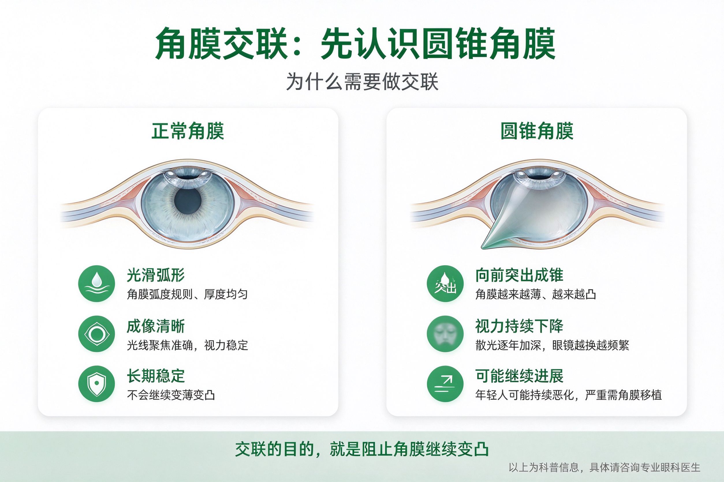 昆明哪家医院可以做角膜交联手术？设备配置与技术保障解析